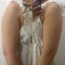 멍이가 웃통벗는날 | 강남지방흡입 , 고민 많았던 내돈내산 팔뚝지방흡입 2주차 후기