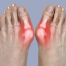 올바른마디튼튼의원 이미지