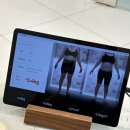 바인 | 강남한의원 지방분해 V메타쉐이프 솔직후기 바인허브한의원