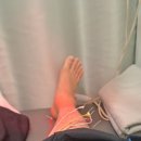 금맥한의원 | 20대 남자 발목인대 파열 후기 (3일차/4일차)