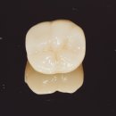 최신심미치과기공소 이미지