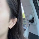 강남샘약국 | 이수열 귀찢어짐 수술 내돈내산 후기 (실손 실비 보험 가능한 병원?)