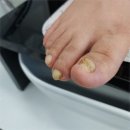 에이네일 이미지