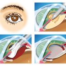 한사랑안과 이미지