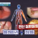 몸에 염증 싹 빼주는 이 음식 이미지