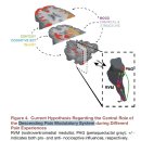 The Cerebral Signature for Pain Perception and Its Modulation - 꼭 한번은 읽어야 할 논문 이미지