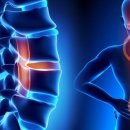 편한허리신경외과 이미지