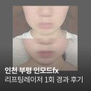 1회 사진기록전 | 인천 부평 피부과 인모드fx 리프팅 레이저 1회 후기 (1주 경과 기록/통증, 효과, 멍)