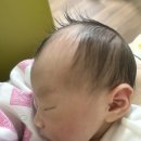 250317 ✨ 딱지탄생 ✨🍼 초산모 제왕절개 후기 * 무통주사 페인부스터 * 무통주사 부작용 🔥