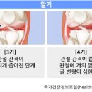 운동생활 이미지