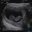 청아여성의원 이미지