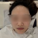 36 | 양산증산에스테틱|피부디톡스후기|올가드림뷰티증산점