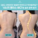 2B커스텀 | [송도 신부관리] 얼굴만 만진다고 작아질까요? '시너지 페이스 바디'로 숨은 윤곽 찾기
