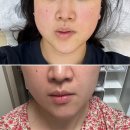 파주 피부관리 어디서 받아야 할까?제와이제이뷰티 직접 다녀온 후기 공유해요