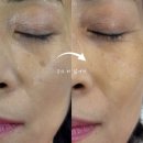 에이브로우 이미지