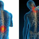 SNPE척추운동 이미지