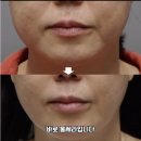 스토리피부과의원 이미지