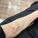 세광의료재단 | [봄철 알러지 비염]꽃가루 알레르기 있으신가요