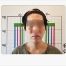 윤쌤한의원 | 대구 긴얼굴축소 석고본으로 증명하는 확실한 V라인 변화