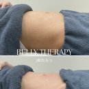 뷰티엠슬림 이미지