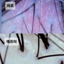 숲칼프 문정점 / 문정동 두피관리 두피스케일링 프리미엄 관리샵 추천