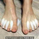 손태석 발가락운동용구 이미지