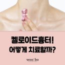 우보분당