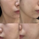 한번만으로도 효과보는 미백윤곽관리, 동래 더 아름다움 에스테틱 후기