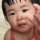 뉴메드 | 아기 피부때문에 다녀온 천안 뉴이진소아과, 처방 후 좋아진 후기