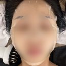 둔산중로-34 | 둔산동 윤곽관리 아로뮤에스테틱 뮤프팅 솔직후기