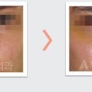 앤써성형외과의원 이미지