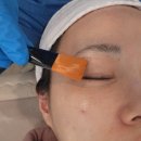 다나아 한의원 | 부산 해운대역 피부과 눈밑주름 김나영 리프팅 아이볼뉴머 후기 (눈밑지x)