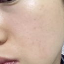 피부숨쉬다 이미지