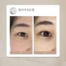 럽아이속눈썹