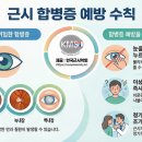 바른아이안경, 콘택트 조선비즈