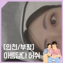 [인천/부평] 인천브로우샵 &#39;아름답다허쉬&#39;에서 잔흔제거 후기