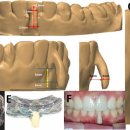 시스루테크 이미지