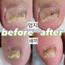 아나타노네일&큐릭스대구 | 대구 수성구 네일 ㅣ 대구 수성구 문제성발톱 ㅣ 아나타노 (anatano) 네일&큐릭스 대구상동점