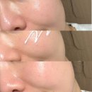 서해병원 | 민감피부 선크림 추천, 출산 후 예민해진 피부에 써본 서해솔 엑토인 후기