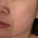 오목로 | 미인본가 목동점 작은얼굴관리 후기 | 결혼식 준비 리프팅 관리 효과 굿