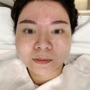 과천예일의원 | 과천 피부관리 웨딩케어 과천예일의원 미소지앤 캐비어 재생 관리 후기