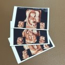 👶 임신기록 8주부터 12주까지:난임병원 졸업/임산부 배탈/입덧/1차 기형아검사/좋은날에드라마여성병원...