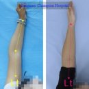 강남챔피언정형외과의원 이미지