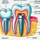 세연치과의원 | 서울 중구 충무로 임플란트 치과 가격 비용 싼 곳,저렴한 곳,잘하는 곳,유명한 곳 BEST8 추천