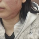 브이에스(VS)의원 네이버블로그