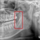 안아픈치과의원 이미지