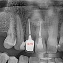 아트리움치과기공소 이미지