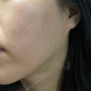 피부 장벽 안티에이징 프레이닌 마린 프리저브 해양바이오 크림 추천