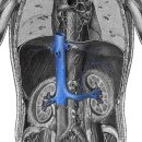 inferior vena cava(아래대정맥) 이미지