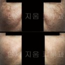 연세지움